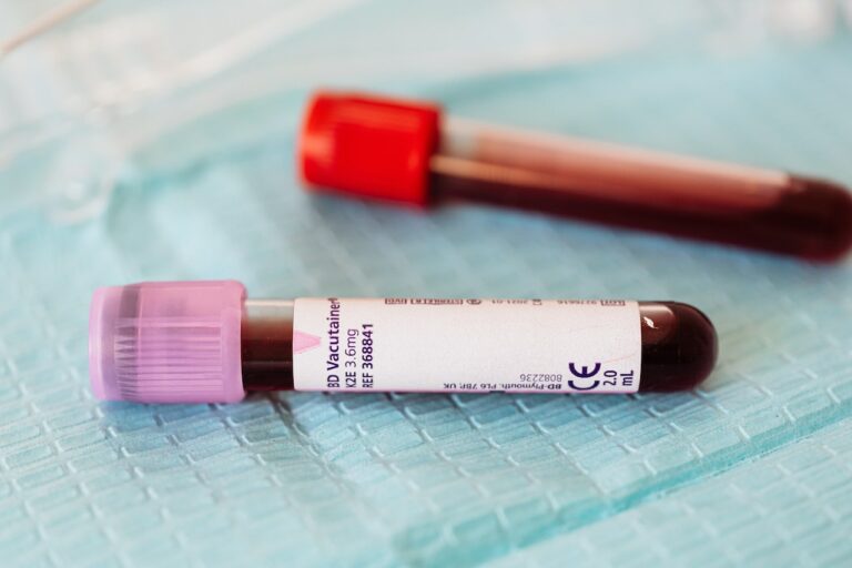 בדיקת דם כללית בצום היא כלי אבחון מקיף המספק תובנות חשובות לגבי בריאותו הכללית של האדם.